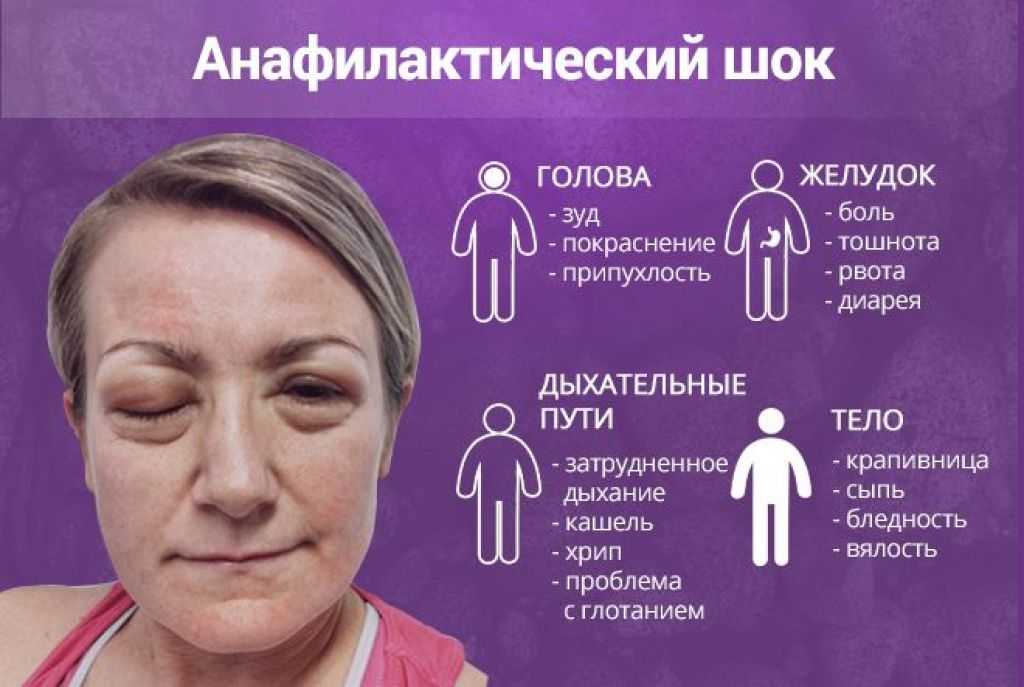 Какую рыбу можно есть при гипоаллергенной диете? ограничения и рекомендации